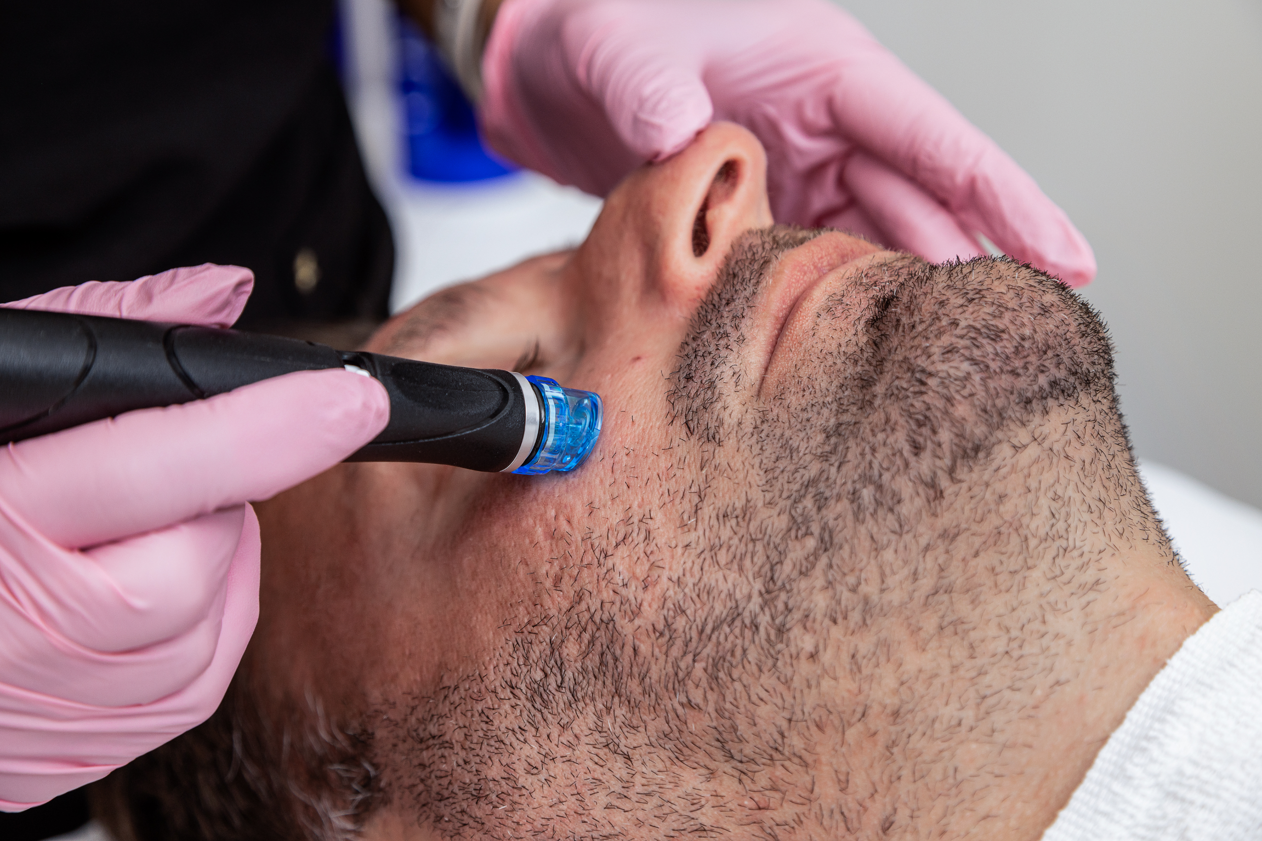HydraFacial for Men ProMD Health