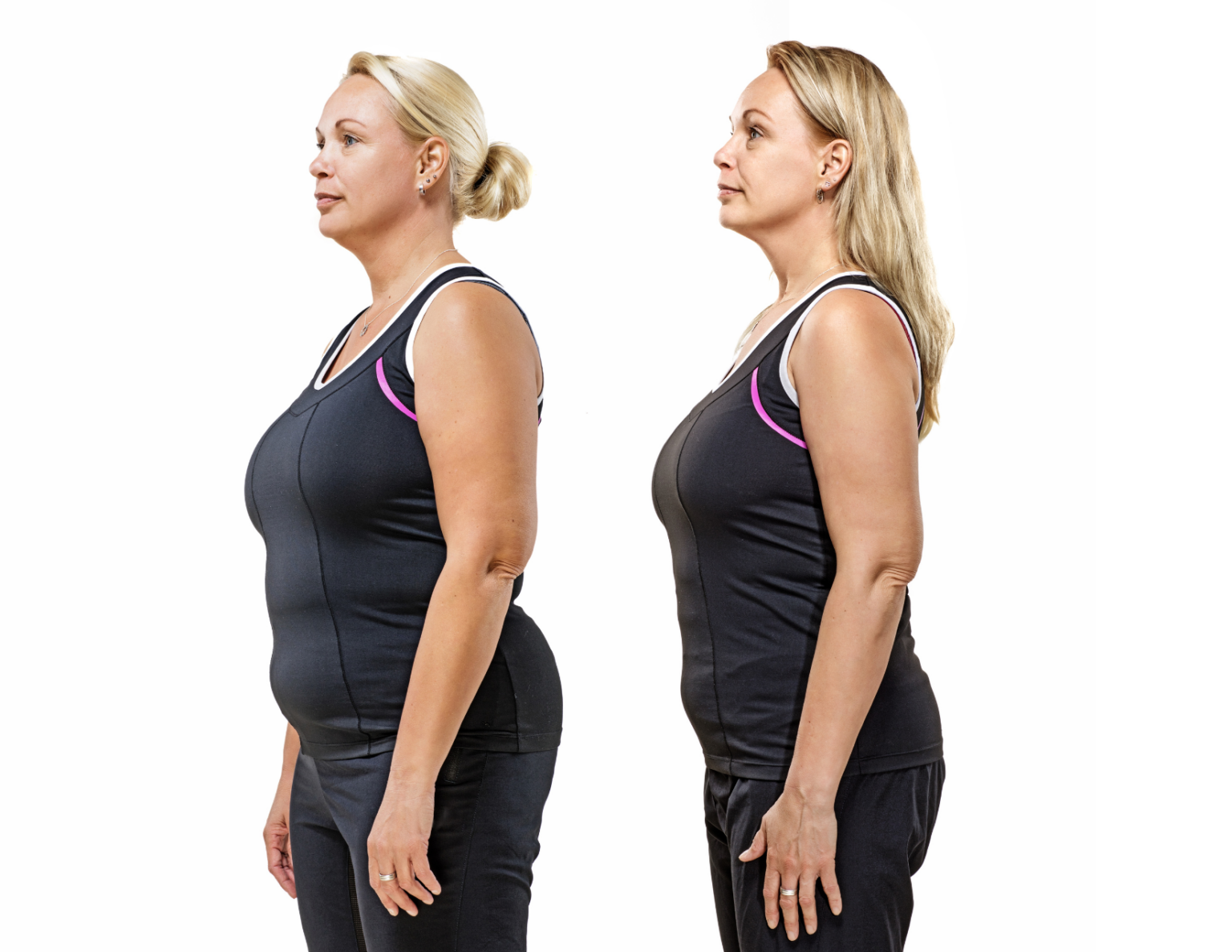 How Does it Work Weight Management ProMD Health