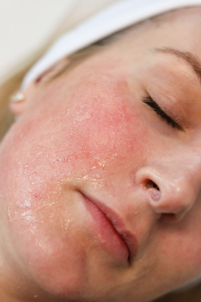 Skin Rejuvenation Announcement ProMD Health tablet