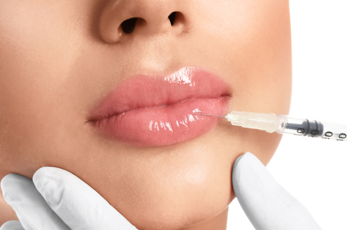 Dermal Fillers